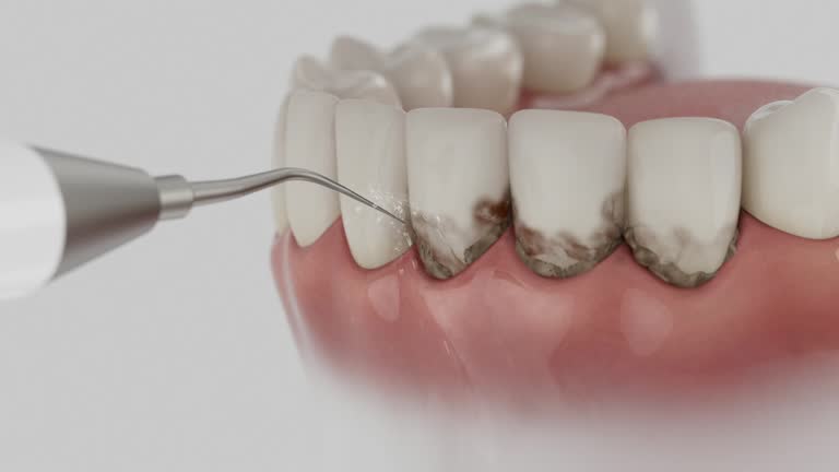 Reliable Dental contractor in Morristown, IN by Dentist Open Now